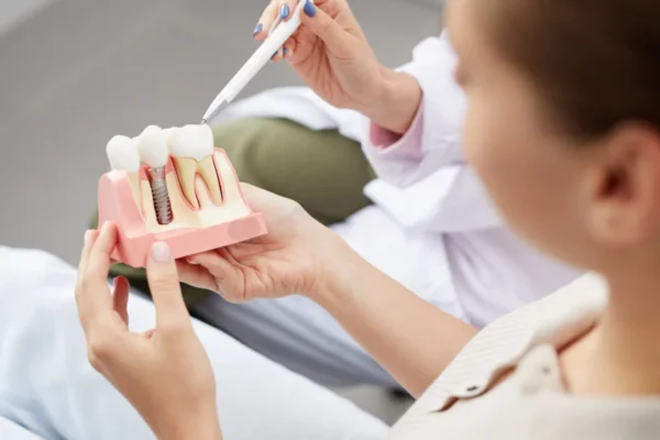 Exploring the Role of Dental Implants in Fixing Broken Teeth