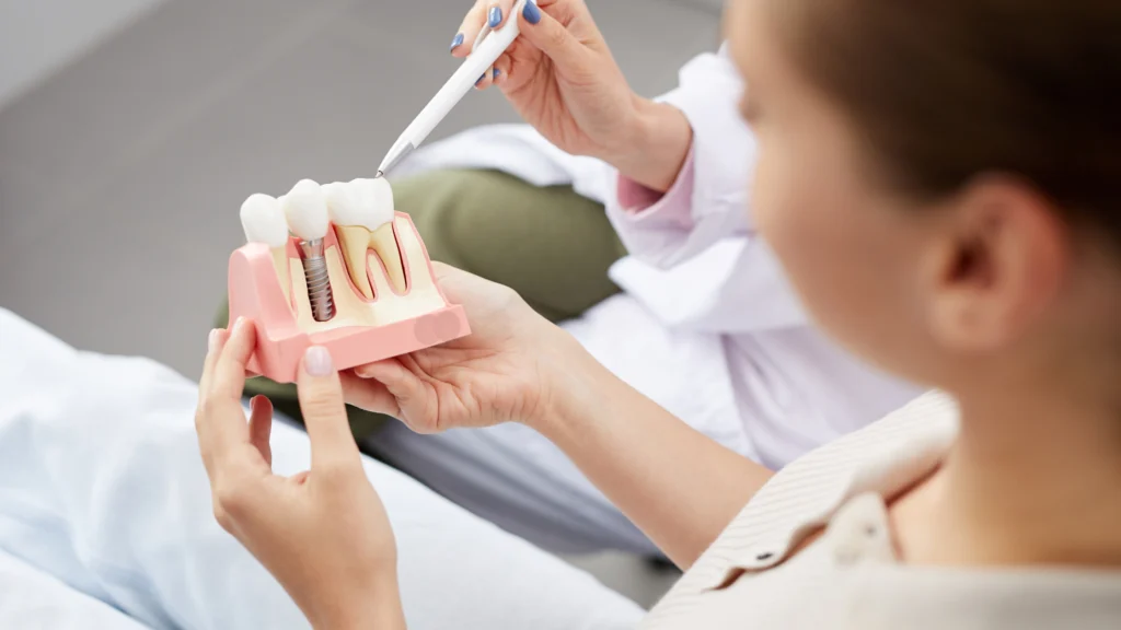 Dental Implants for Broken Teeth